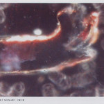 DF1