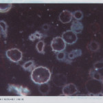 DF1