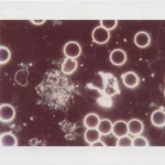 DF9