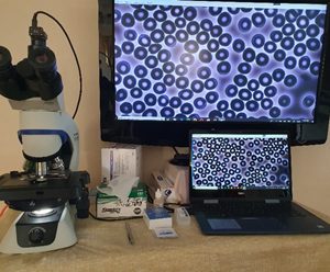 Economy CX-43 LBM/CBM Blood Microscope System