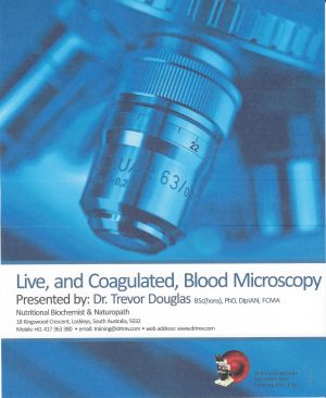TBM/LBM/CBM Full Course Notes